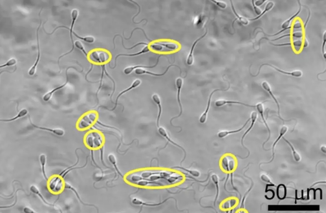 Sædceller samarbejder, Foto: Chih-Kuan Tung